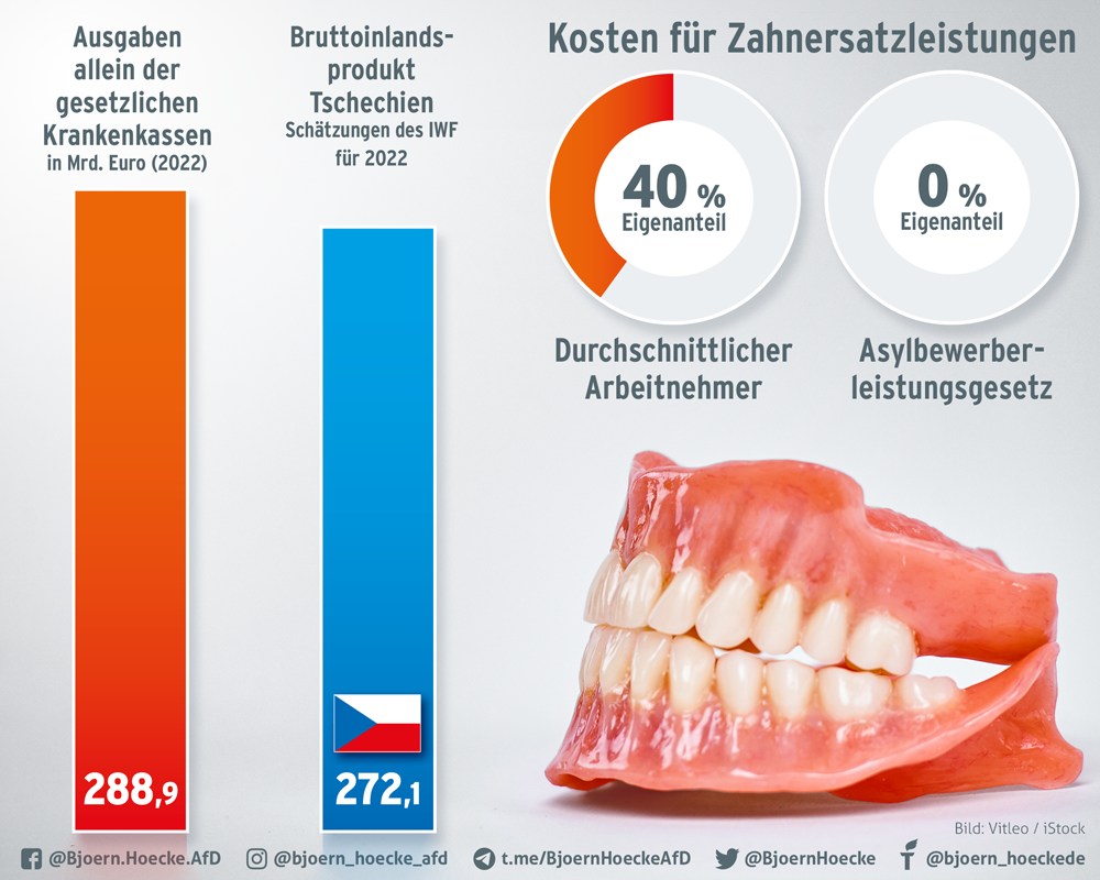 Kosten für Zahnzusatzleistungen